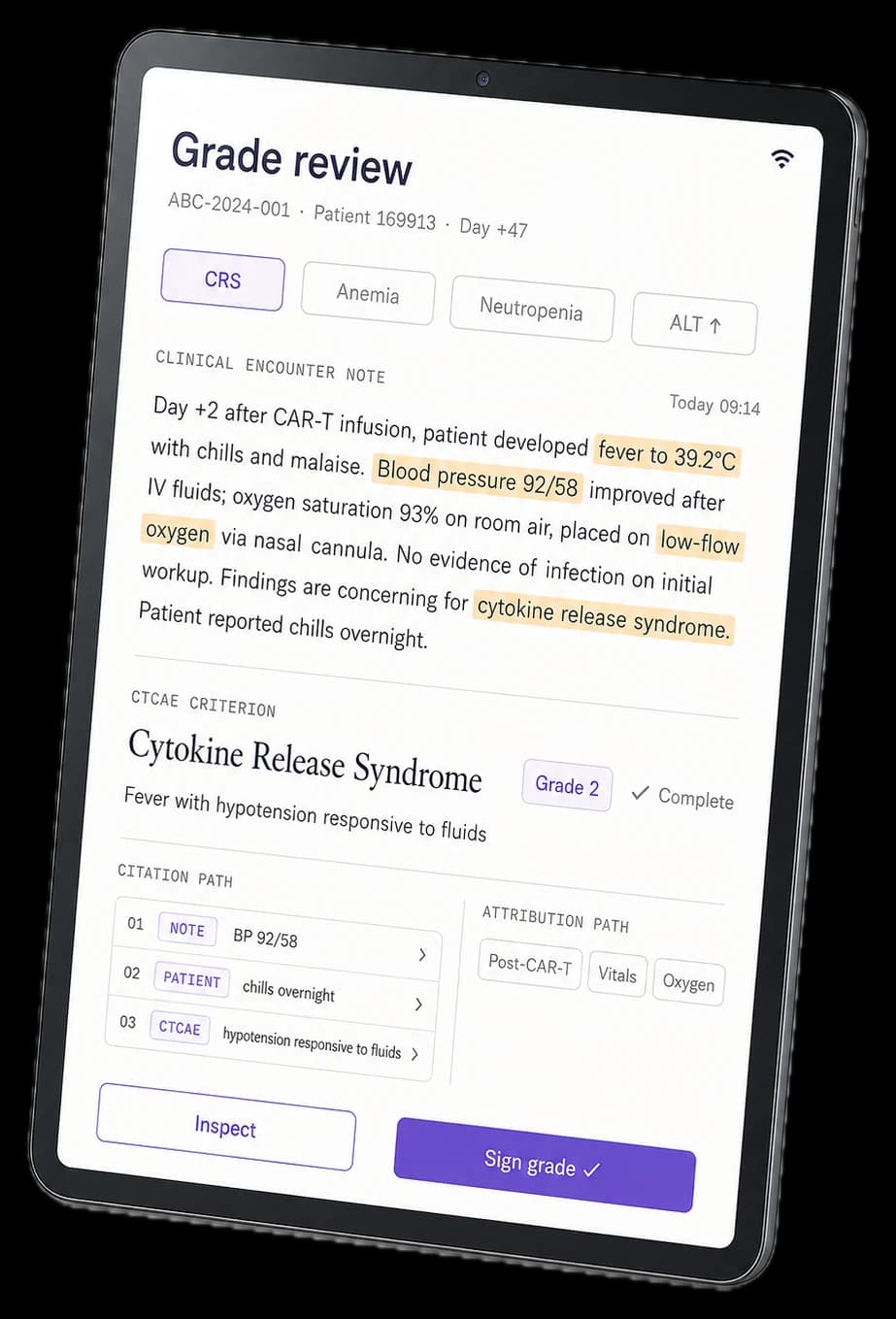 Rendered tablet showing the Grade review screen: a clinical note resolved into a Grade 2 cytokine release syndrome finding with citation and attribution paths.